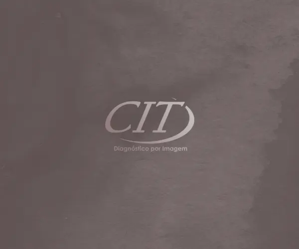 Tomografia Computadorizada